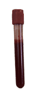 Red Top Blood Tube